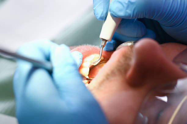 Best Emergency Orthodontic Services in Mount Sterling, IL