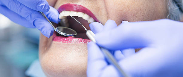 Best Emergency Treatment for Dental Infections or Abscesses in Mount Sterling, IL